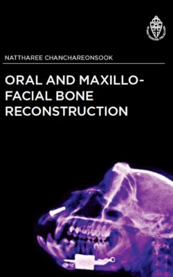 Oral and Maxillo-Facial Bone Reconstruction